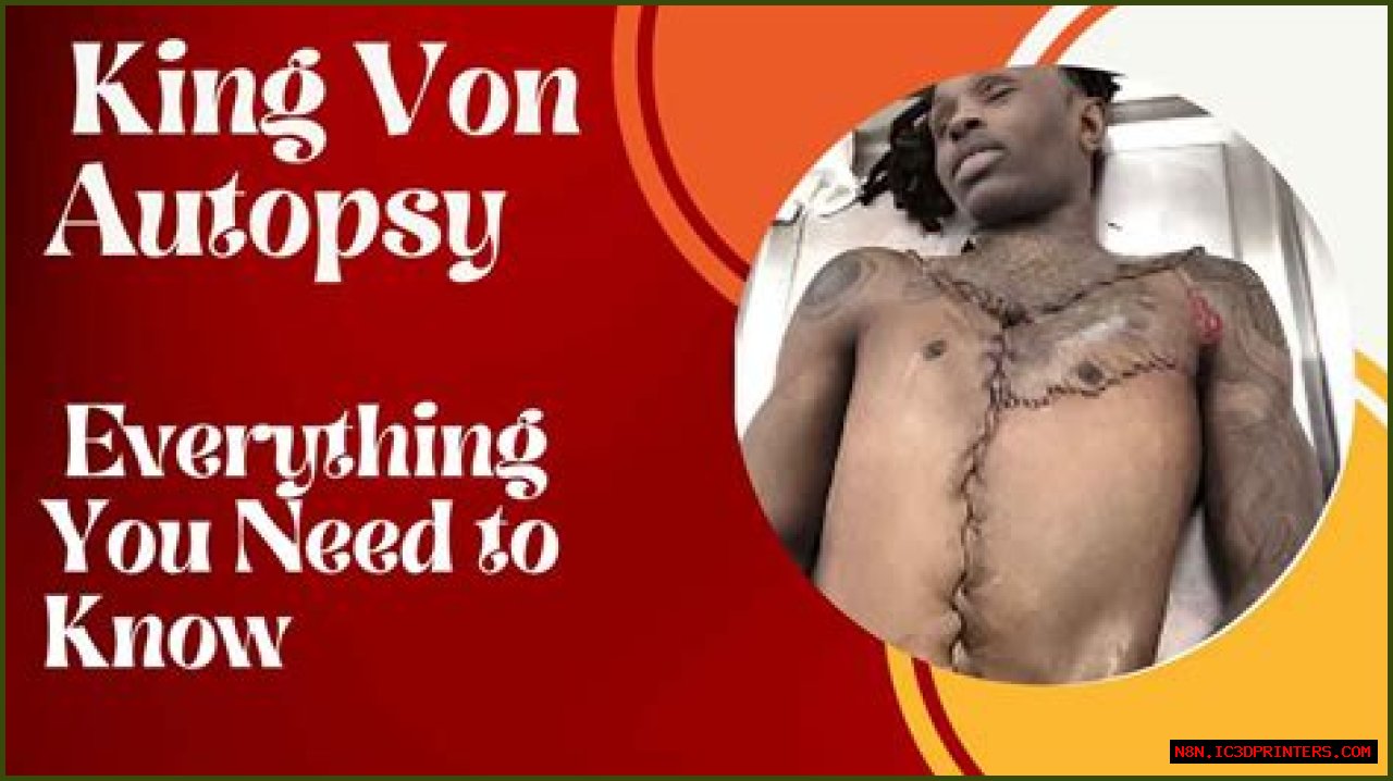 King Von Autopsy Photo: An Insight Into The Life And Legacy Of A Rising Star